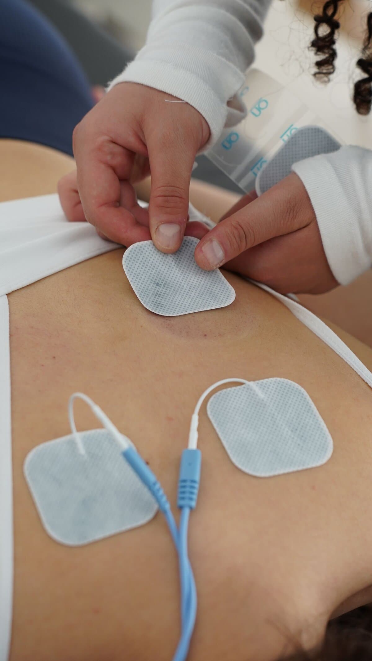Electrical stimulation pads applied to a patient's back during a muscle stimulation therapy session